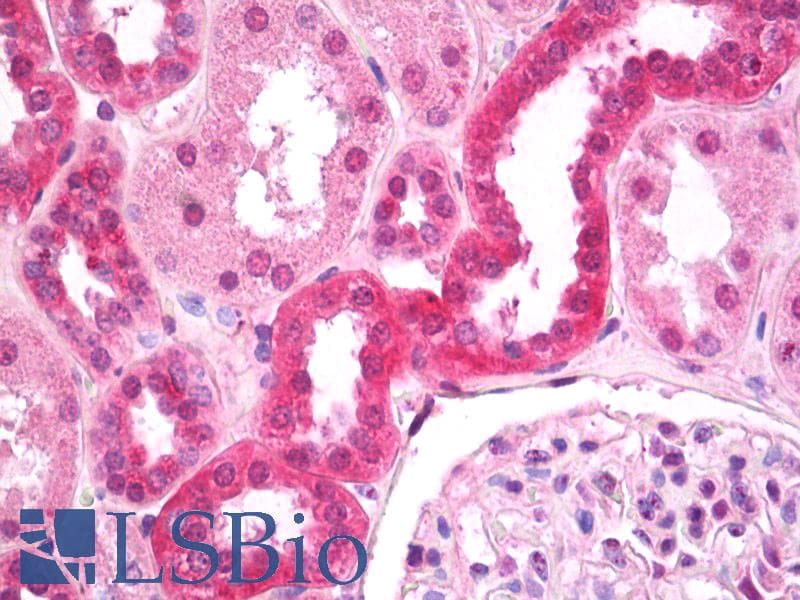 IHC-plus™ CASR/Calcium Sensing Receptor Antibody (aa214-235, clone ADD)