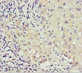 AKR7A2 / AFAR Antibody