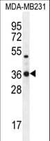 TPSD1 / Tryptase Delta 1 Antibody (aa164-193)