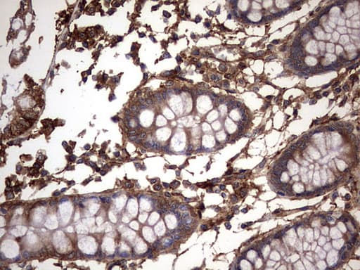 KRT7 / CK7 / Cytokeratin 7 Antibody (clone OTI2A2)
