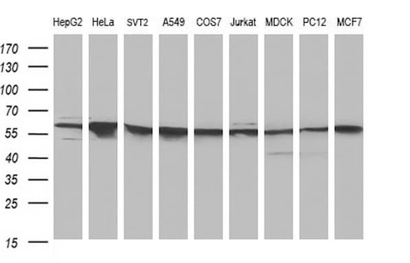 FGG / Fibrinogen Gamma Antibody (clone OTI5C9, Carrier-free)