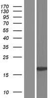 Human Spondyloepiphyseal dysplasia, late, pseudogene (SEDLP) Protein (Over-Expression Lysate Myc-DDK (Flag))