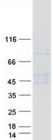Human FCGR3A / CD16A Protein (Recombinant Myc-DDK (Flag))