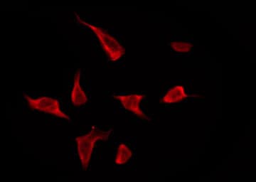 Polyclonal Rabbit anti-Human OR5AR1 Antibody (IF, WB)