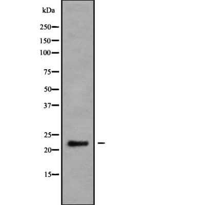NRSN2 Antibody