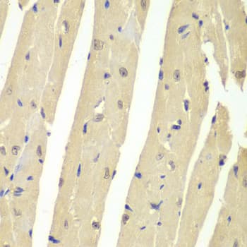 USP7 / HAUSP Antibody