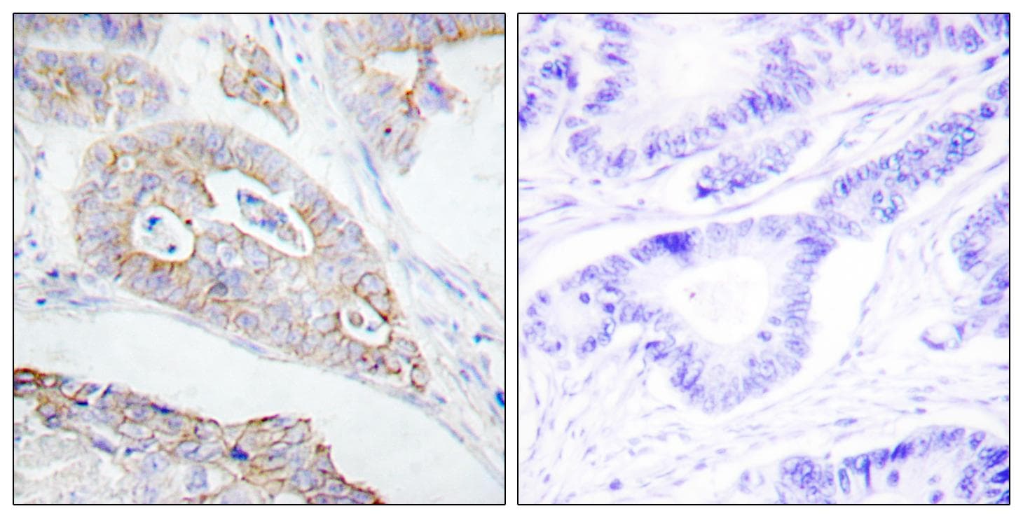 CD45 / LCA Antibody
