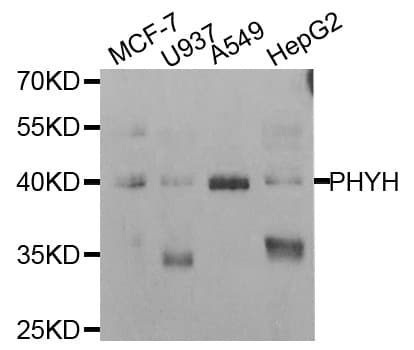 RD / PHYH Antibody