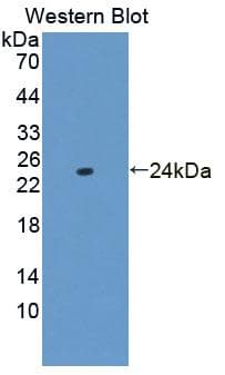 TNF Alpha Antibody
