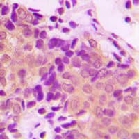 ACTN1+2+3+4 Antibody (N-Terminus)