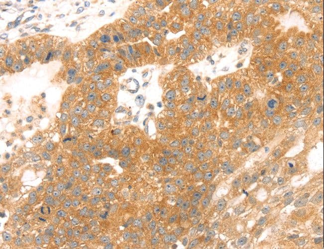 IHC-plus™ TMEFF2 Antibody