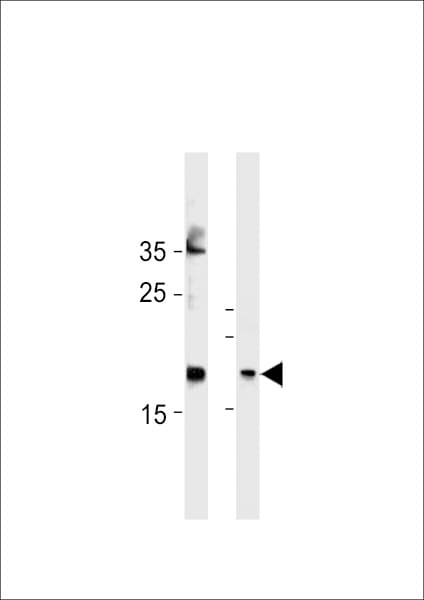 Polyclonal Rabbit anti-Human FAM159A Antibody (aa89-115, WB)
