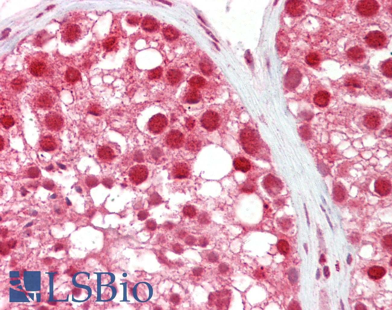 IHC-plus™ Polyclonal Goat anti-Human MSH5 Antibody (aa508-519, IHC)