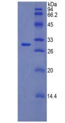 Human F5 / Factor Va Protein (Recombinant His)