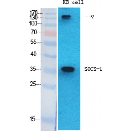 SOCS1 Antibody (Internal)