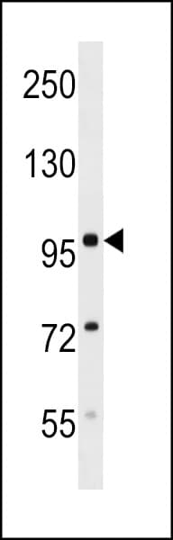 Polyclonal Rabbit anti-Mouse SDCCAG1 / NEMF Antibody (aa236-264, WB)