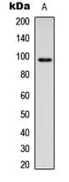ITGB2 / CD18 Antibody (Internal)