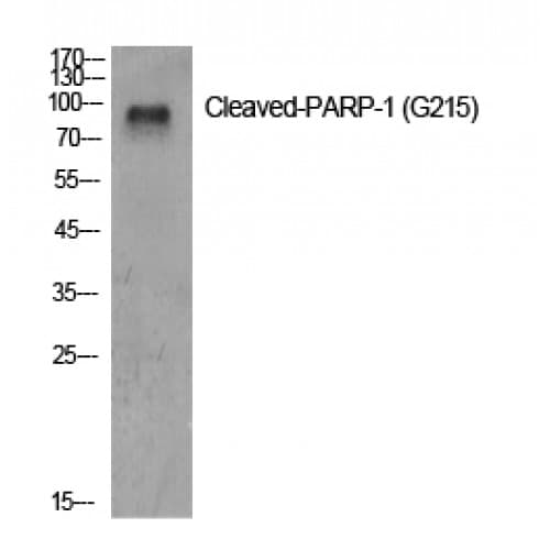 PARP1 Antibody (170-250 aa, Internal)