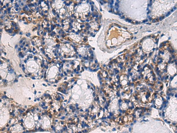 Polyclonal Rabbit anti-Human ABHD14B Antibody (IHC, WB)