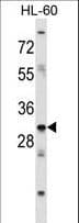 HOXB9 Antibody (aa148-176)