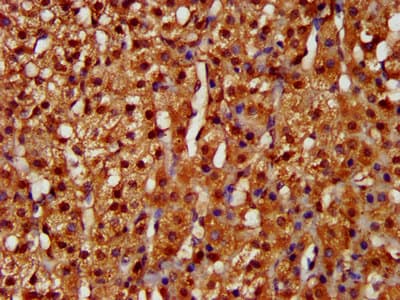 Polyclonal Rabbit anti-Human LARP6 / ACHN Antibody (IHC)