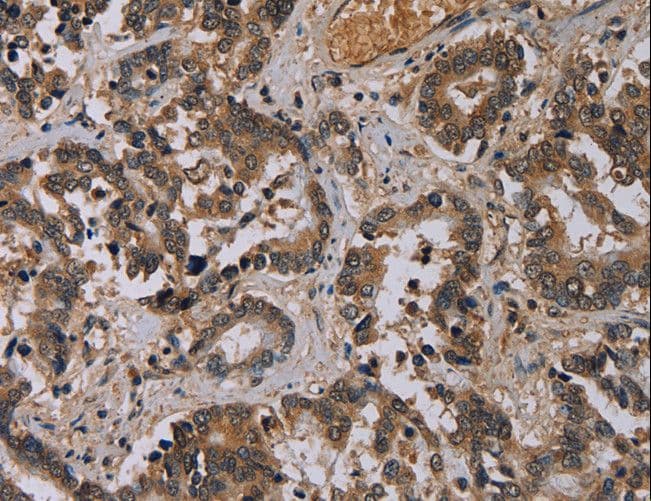 Polyclonal Rabbit anti-Human ICAM4 / CD242 Antibody (IHC)