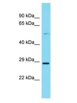 Polyclonal Rabbit anti-Human ITPRIPL2 Antibody (aa485-534, WB)
