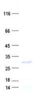 Human C18orf21 Protein (Recombinant His, N-Terminal)