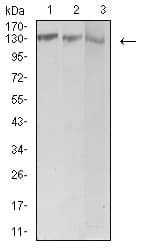 Monoclonal Mouse anti-Human CML / BCR Antibody (clone 1E11G12, WB)