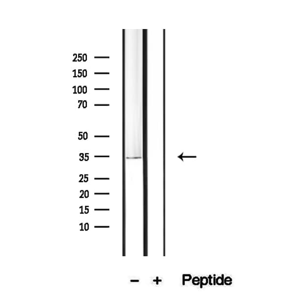 PDHB Antibody