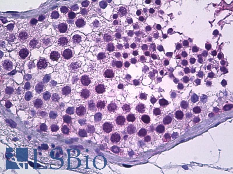 IHC-plus™ Polyclonal Rabbit anti-Human SOX9 Antibody (aa147-196, IHC, IF, WB)