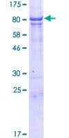 Human RMDN3 Protein (Recombinant GST)