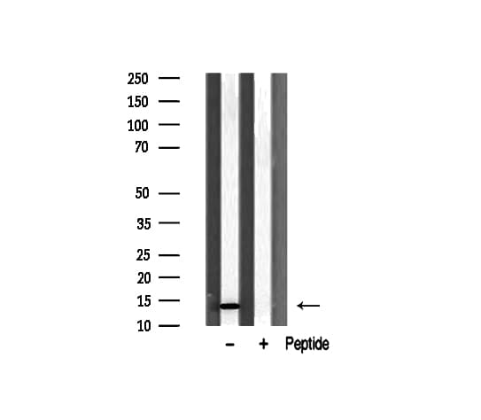 RPL31 / Ribosomal Protein L31 Antibody