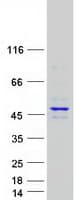 Human RBM41 Protein (Recombinant Myc-DDK (Flag))