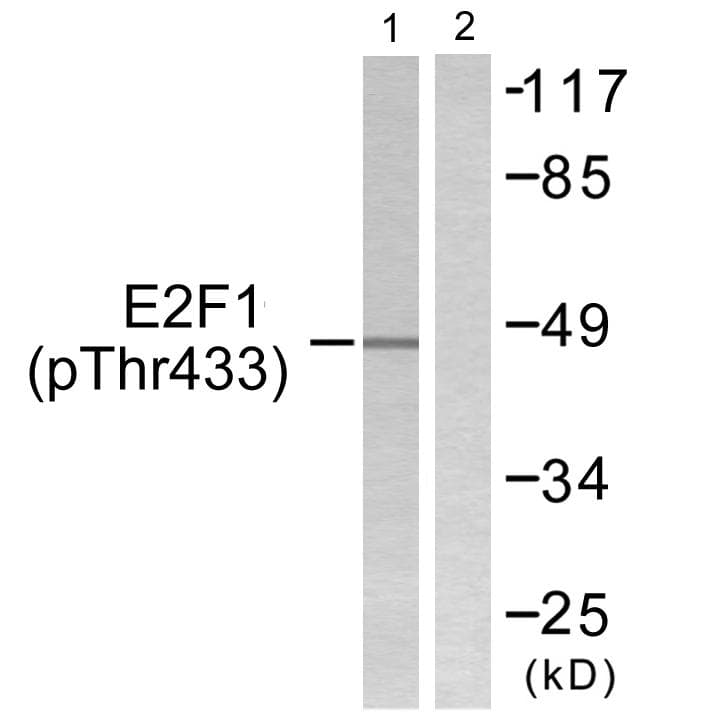 Polyclonal Rabbit anti-Human E2F1 Antibody (phospho-Thr433, WB)