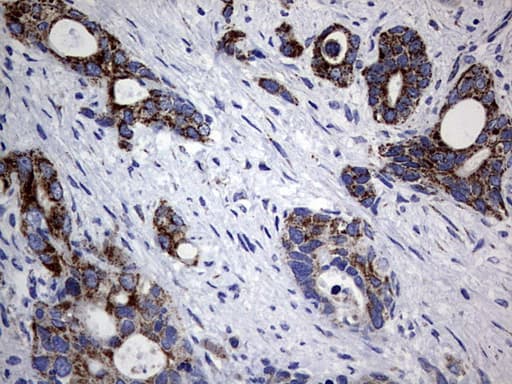 PIK3CD / PI3K Delta Antibody (aa286-610, clone OTI6A12)