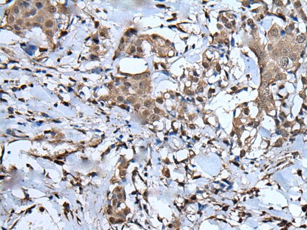 UBA52 Antibody
