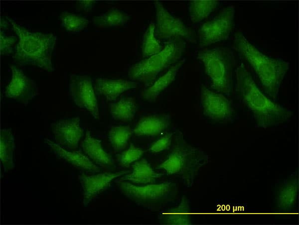 IHC-plus™ SMURF1 Antibody (clone 1D7)