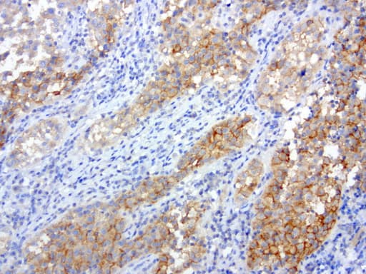 c-Met Antibody (aa570-885, clone UMAB190)