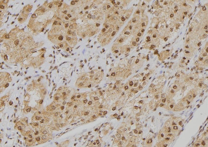 POGZ Antibody