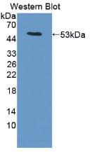 LRG1 / LRG Antibody (aa136-342)