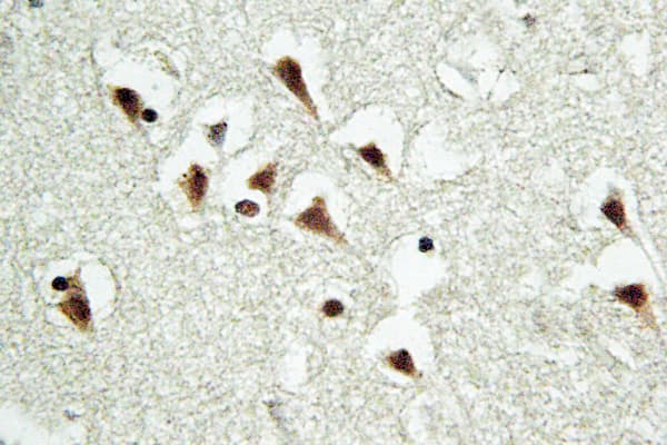 TUBGCP5 / GPC5 Antibody (Ile779)