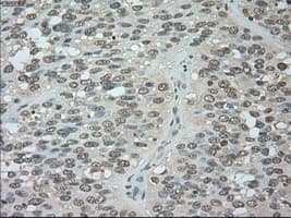 BUB1B / BubR1 Antibody (clone OTI3C7)