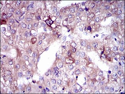 SLC27A5 / BACS Antibody (Amino Acid: 508-570, clone 4B11C10)