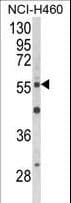 AKT2 Antibody