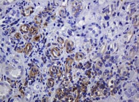SOAT2 Antibody (clone OTI2D3)