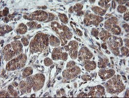 Monoclonal Mouse anti-Human TRAPPC4 / Synbindin Antibody (clone OTI2G8, IHC, WB)