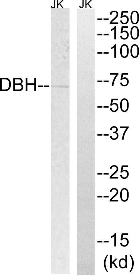 Polyclonal Rabbit anti-Human DBH/Dopamine Beta Hydroxylase Antibody (WB)