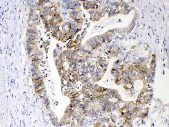 EPCAM Antibody