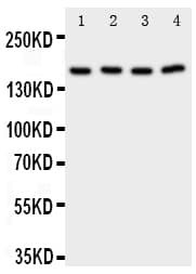 Polyclonal Rabbit anti-Human PLA2G4A Antibody (aa686-700, WB)